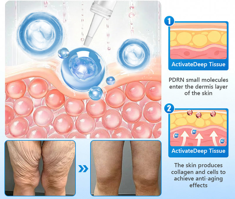 𝐕𝐈𝗧𝗔𝐋𝐈𝑺𝒀𝑺 𝑷𝗗𝐑𝑵 𝐀𝐧𝐭𝐢-𝐚𝐠𝐞💧𝐅𝐢𝐫𝐦𝐢𝐧𝐠 𝐒𝐞𝐫𝐮𝐦 𝐍𝐚𝐭𝐮𝐫𝐚𝐥 𝐈𝐧𝐠𝐫𝐞𝐝𝐢𝐞𝐧𝐭𝐬👩‍⚕𝐌𝐚𝐢𝐧𝐭𝐚𝐢𝐧 𝐒𝐤𝐢𝐧 𝐄𝐥𝐚𝐬𝐭𝐢𝐜𝐢𝐭𝐲,𝐌𝐚𝐲 𝐑𝐞𝐝𝐮𝐜𝐞 𝐖𝐫𝐢𝐧𝐤𝐥𝐞𝐬，𝐈𝐦𝐩𝐫𝐨𝐯𝐞 𝐒𝐤𝐢𝐧 𝐌𝐨𝐢𝐬𝐭𝐮𝐫𝐞，𝐌𝐚𝐢𝐧𝐭𝐚𝐢𝐧 𝐇𝐞𝐚𝐥𝐭𝐡𝐲 𝐒𝐤𝐢𝐧 𝐒𝐭𝐫𝐮𝐜𝐭𝐮𝐫𝐞，𝐌𝐮𝐥𝐭𝐢𝐩𝐥𝐞 𝐀𝐧𝐭𝐢-𝐀𝐠𝐢𝐧𝐠 𝐅𝐨𝐫𝐦𝐮𝐥𝐚𝐬️