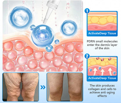 𝐕𝐈𝗧𝗔𝐋𝐈𝑺𝒀𝑺 𝑷𝗗𝐑𝑵 𝐀𝐧𝐭𝐢-𝐚𝐠𝐞💧𝐅𝐢𝐫𝐦𝐢𝐧𝐠 𝐒𝐞𝐫𝐮𝐦 𝐍𝐚𝐭𝐮𝐫𝐚𝐥 𝐈𝐧𝐠𝐫𝐞𝐝𝐢𝐞𝐧𝐭𝐬👩‍⚕𝐌𝐚𝐢𝐧𝐭𝐚𝐢𝐧 𝐒𝐤𝐢𝐧 𝐄𝐥𝐚𝐬𝐭𝐢𝐜𝐢𝐭𝐲,𝐌𝐚𝐲 𝐑𝐞𝐝𝐮𝐜𝐞 𝐖𝐫𝐢𝐧𝐤𝐥𝐞𝐬，𝐈𝐦𝐩𝐫𝐨𝐯𝐞 𝐒𝐤𝐢𝐧 𝐌𝐨𝐢𝐬𝐭𝐮𝐫𝐞，𝐌𝐚𝐢𝐧𝐭𝐚𝐢𝐧 𝐇𝐞𝐚𝐥𝐭𝐡𝐲 𝐒𝐤𝐢𝐧 𝐒𝐭𝐫𝐮𝐜𝐭𝐮𝐫𝐞，𝐌𝐮𝐥𝐭𝐢𝐩𝐥𝐞 𝐀𝐧𝐭𝐢-𝐀𝐠𝐢𝐧𝐠 𝐅𝐨𝐫𝐦𝐮𝐥𝐚𝐬️