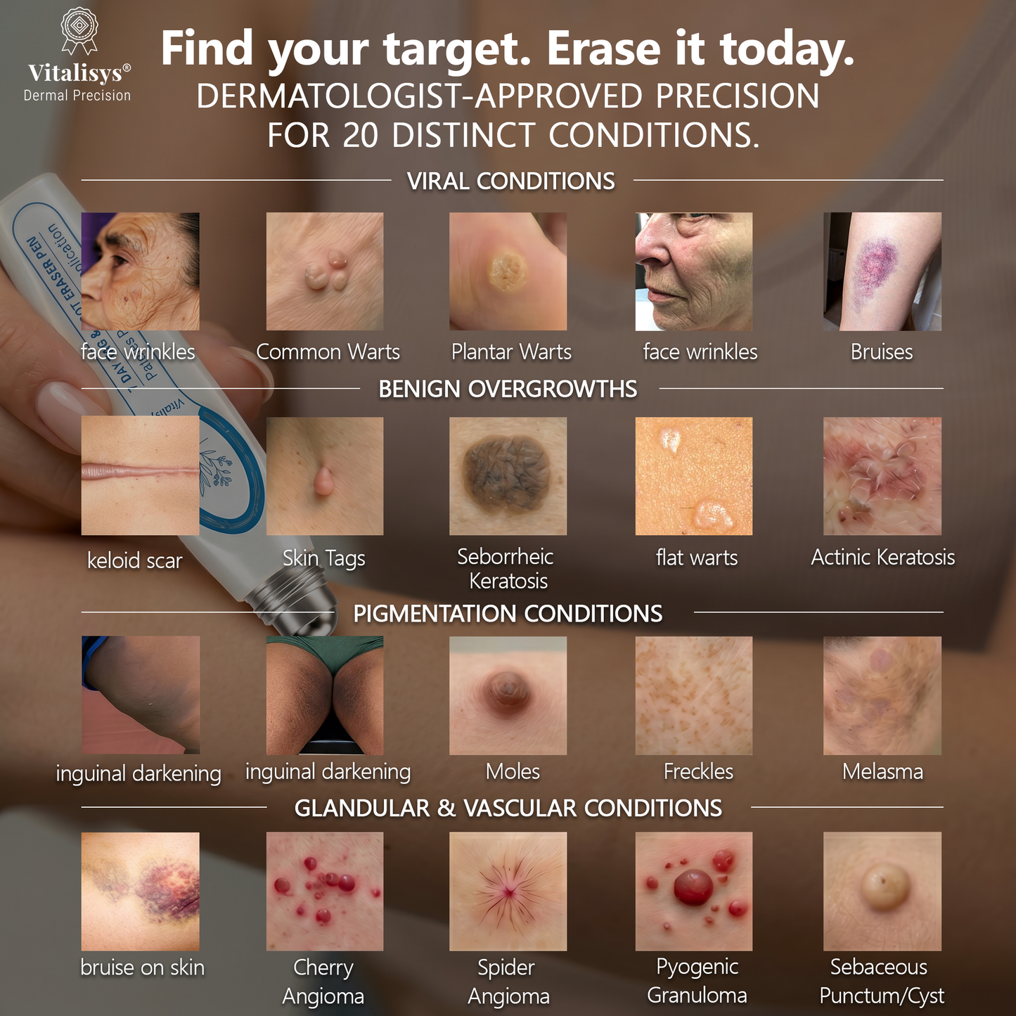 Authorized Flagship Store ✨|🌥️𝐕𝐢𝐭𝐚𝐥𝐢𝐬𝐲𝐬® 7-𝐷𝑎𝑦 𝗧𝐚𝐠 & 𝗦𝗽𝐨𝐭 𝐄𝐫𝒂𝒔𝒆𝒓(Zero Pain, Zero 𝐒𝐜𝐚𝒓𝒔 Rollerball)❤️|Removing moles, warts, facial wrinkles, bruises, scars