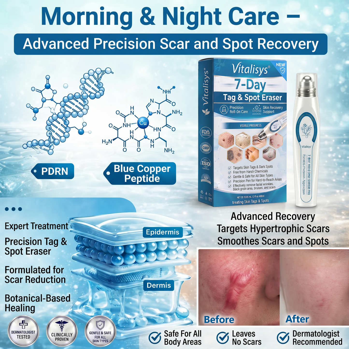 Authorized Flagship Store ✨|🌥️𝐕𝐢𝐭𝐚𝐥𝐢𝐬𝐲𝐬® 7-𝐷𝑎𝑦 𝗧𝐚𝐠 & 𝗦𝗽𝐨𝐭 𝐄𝐫𝒂𝒔𝒆𝒓(Zero Pain, Zero 𝐒𝐜𝐚𝒓𝒔 Rollerball)❤️|Removing moles, warts, facial wrinkles, bruises, scars